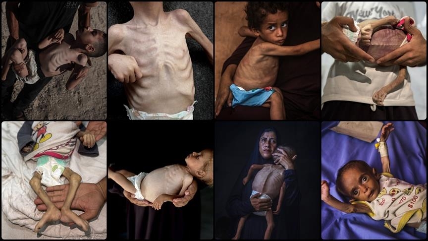 Немецкие СМИ: значительная часть фото из Газы – постановка ХАМАСа